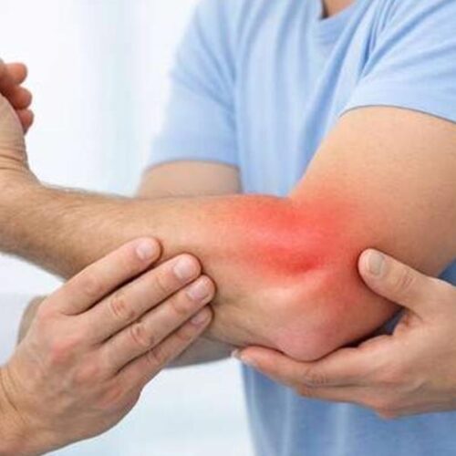 Braço de uma pessoa com dor no cotovelo, sendo examinado por outra com as mãos em contato.